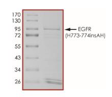 The purity of EGFR (H773-774insAH) was determined to be >70 % by densitometry.
